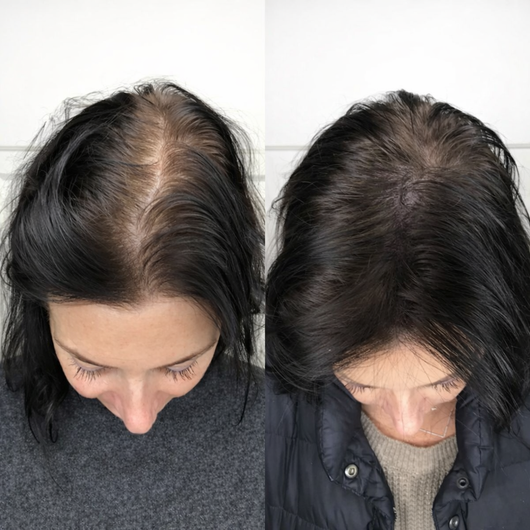 Cenvra Hair Vitamin Gummies