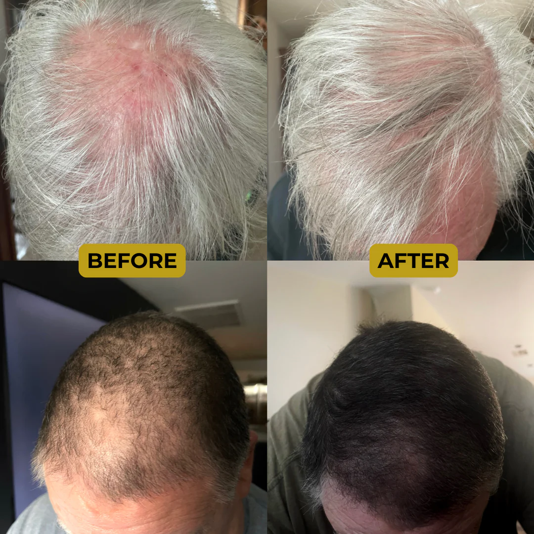 Cenvra™ Batana Oil - Regrow Your Hair in 120 Days