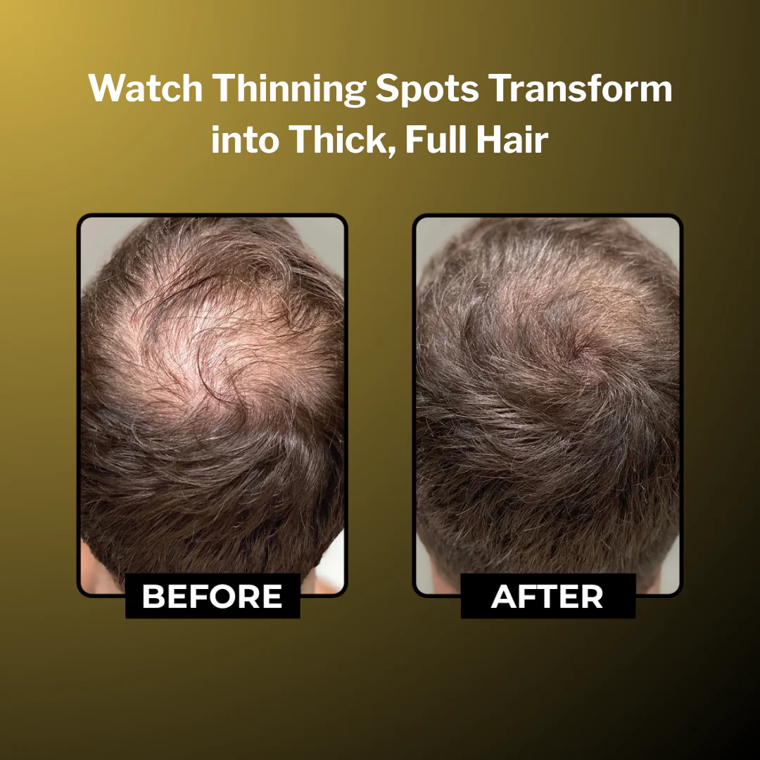 Cenvra™ Batana Oil - Regrow Your Hair in 120 Days