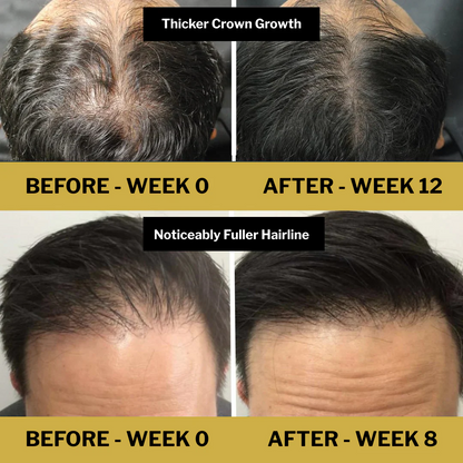 Cenvra™ Batana Oil - Regrow Your Hair in 120 Days